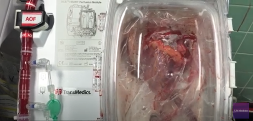 This is the heart used in Stovall's procedure.
